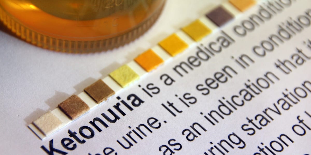 tester les niveaux de cétone dans l'urine tout en essayant d'entrer en cétose
