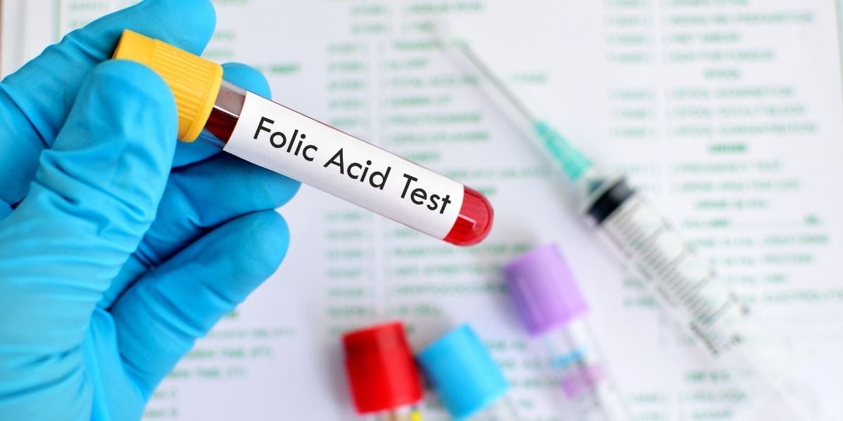 Machen Sie einen Folsäuretest, um herauszufinden, ob Sie nicht metabolisierte Folsäure haben