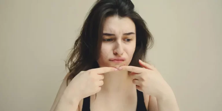 Live Cultures for Acne: Clear Skin Starts in Your Gut