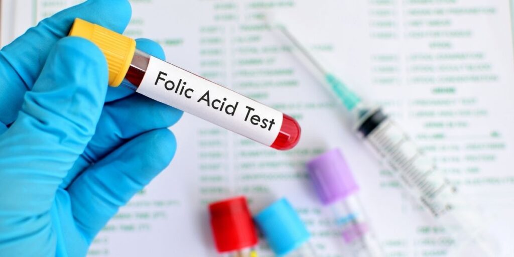 realiza una prueba de ácido fólico para saber si tienes ácido fólico no metabolizado