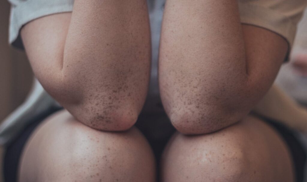Glucosamine chondroïtine is over het algemeen veilig, wat erg belangrijk is voor mensen die vaak joggen of sporten